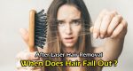 After Laser Hair Removal When Does Hair Fall Out | Big Reveal 2020